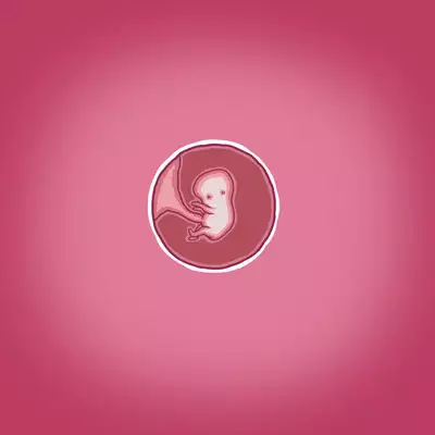 Yumi's Study Abroad/由美的留学生活(汉化)(连载中)