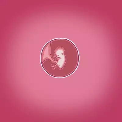 Yumi's Study Abroad/由美的留学生活(汉化)(连载中)