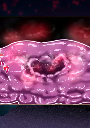 Succubus-san ni Hayasarete Otosarechau!