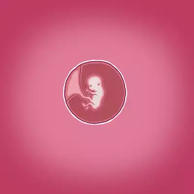 Yumi's Study Abroad/由美的留学生活(汉化)(连载中)